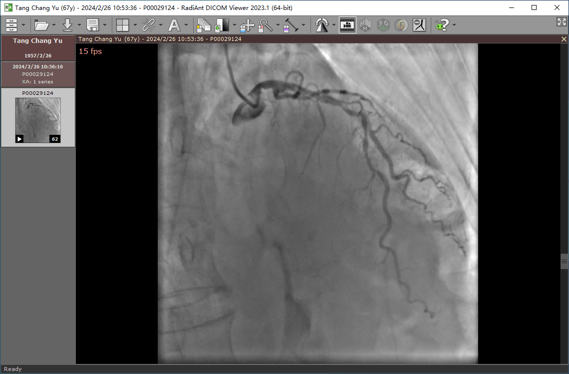 心脏造影视频播放器 绿色版 | RadiAnt DICOM Viewer（2025.1）